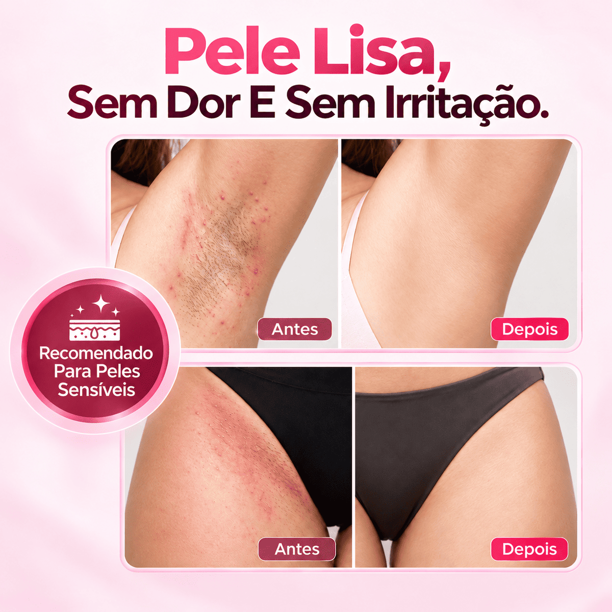 Depilador Elétrico 4 em 1 – DermaFlex™