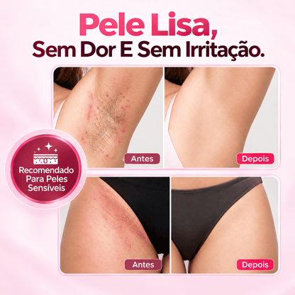 Depilador Elétrico 4 em 1 – DermaFlex™