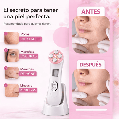 Masajeador Facial 5 en 1