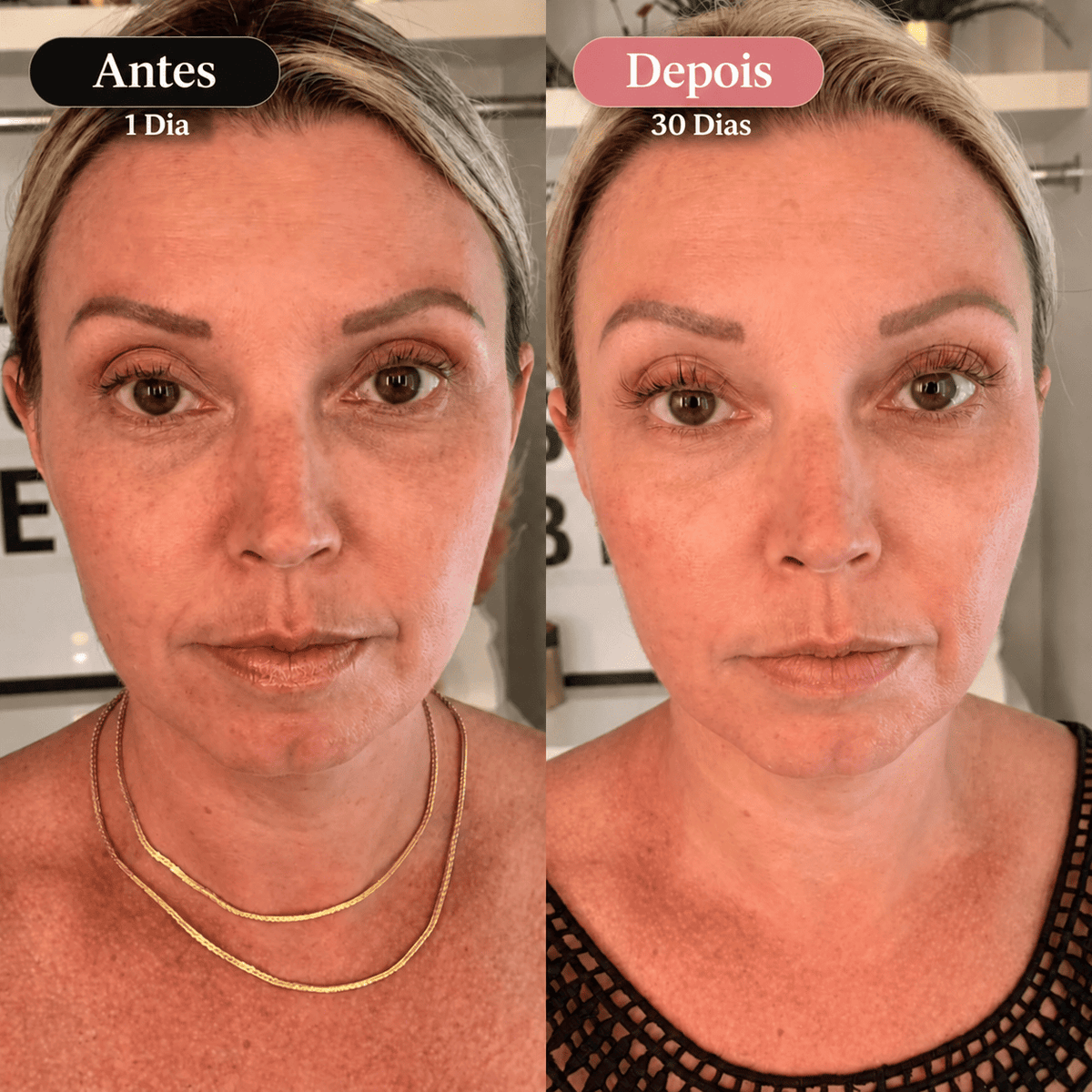 Dê À Sua Pele Um Aspeto Mais Jovem, Uniforme E Revitalizado Com A Máscara Facial GlowUp™