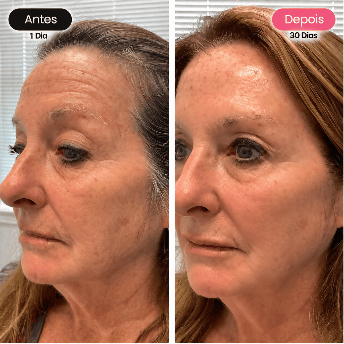 Dê À Sua Pele Um Aspeto Mais Jovem, Uniforme E Revitalizado Com A Máscara Facial GlowUp™