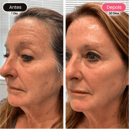 Dê À Sua Pele Um Aspeto Mais Jovem, Uniforme E Revitalizado Com A Máscara Facial GlowUp™