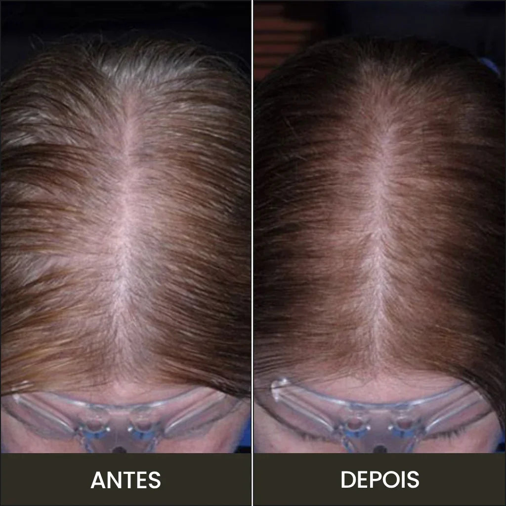 Escova Capilar com Luz Vermelha e Massagem Relaxante